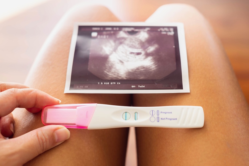 Early pregnancy scan near Wolverhampton