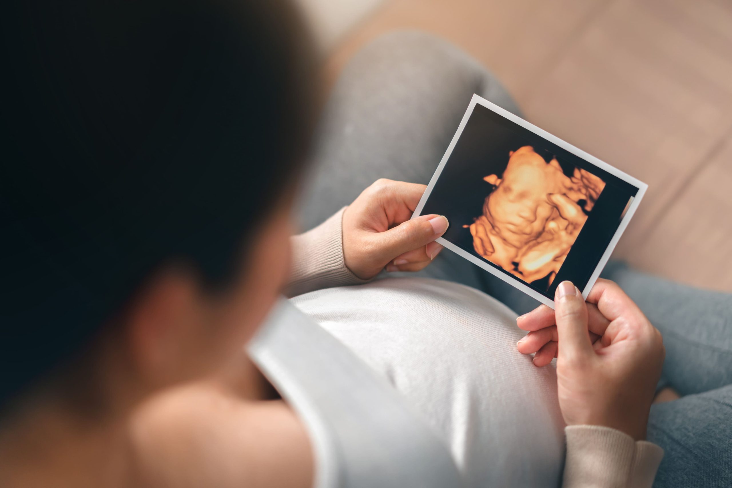 4D Scan