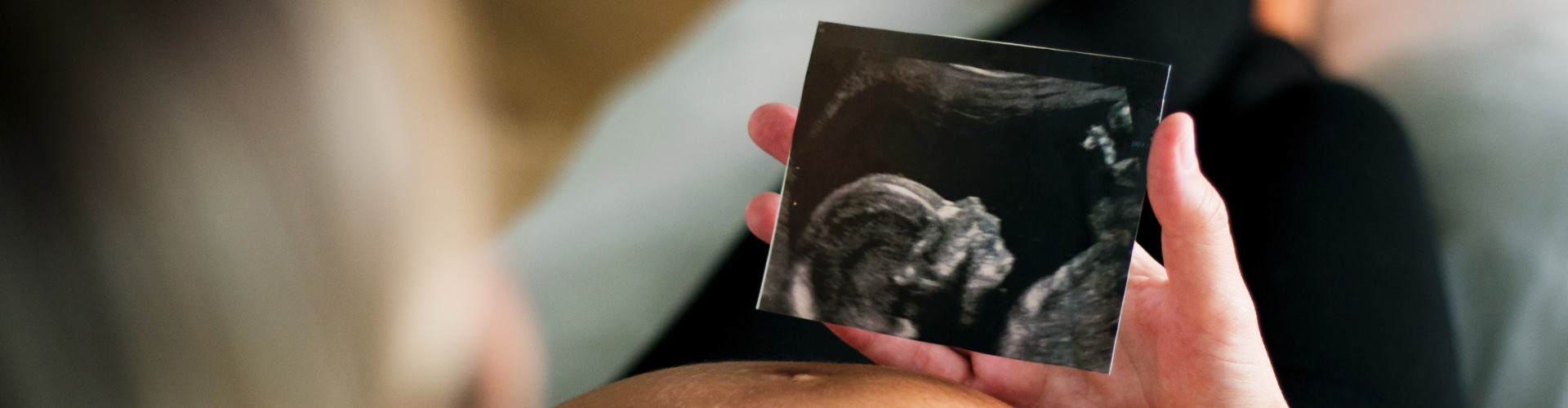 Late Reassurance Scan