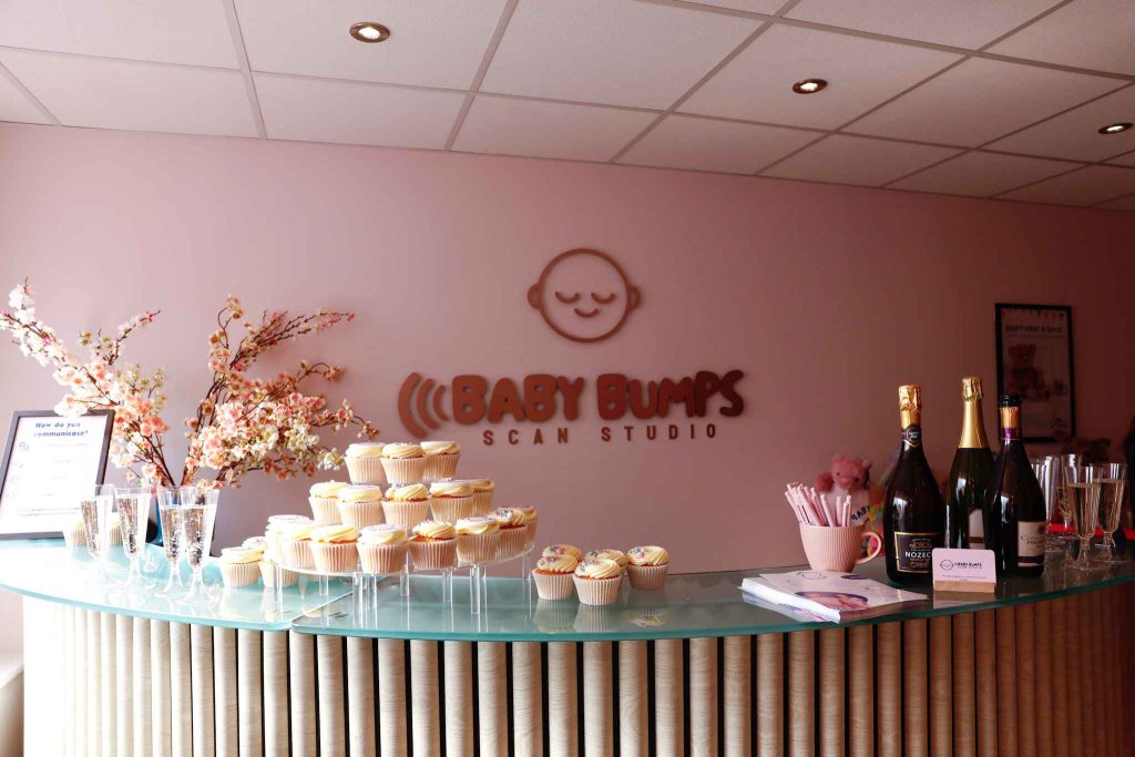Baby Bumps Scan Studio private pregnancy scan clinic near Wolverhampton